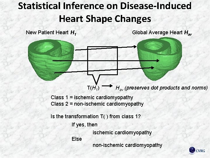 Statistical Inference on Disease-Induced Heart Shape Changes New Patient Heart H 1 Global Average