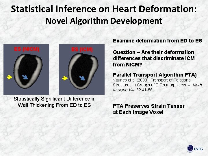 Statistical Inference on Heart Deformation: Novel Algorithm Development Examine deformation from ED to ES