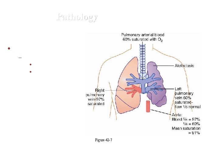 Pathology • Atelectasis – collapse of alveoli • airway obstruction • lack of surfactant