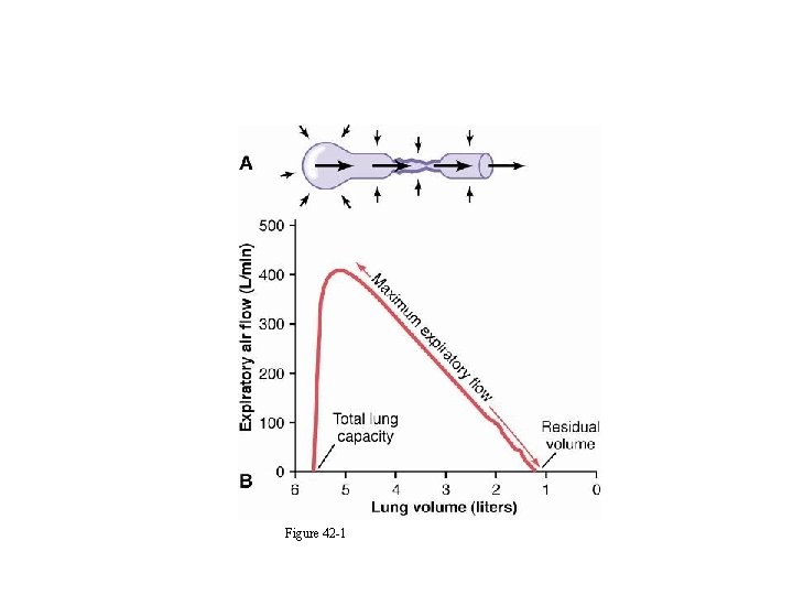 Normal Flow Volume Responses Figure 42 -1 