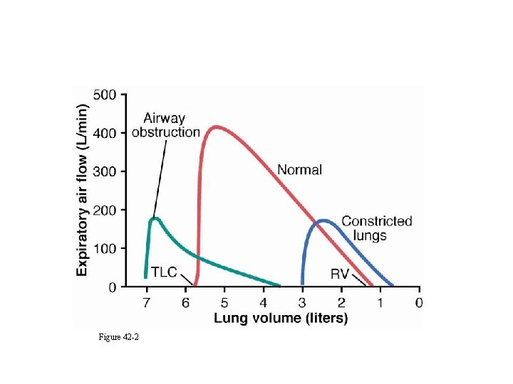 Abnormal Flow Volume Responses Figure 42 -2 