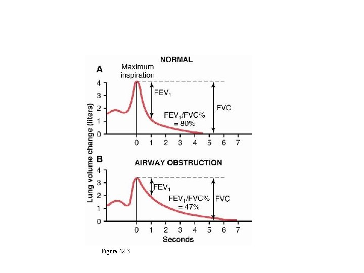 Forced Expiratory Vital Capacity Figure 42 -3 