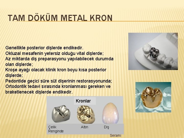 TAM DÖKÜM METAL KRON Genellikle posterior dişlerde endikedir. Okluzal mesafenin yetersiz olduğu vital dişlerde;