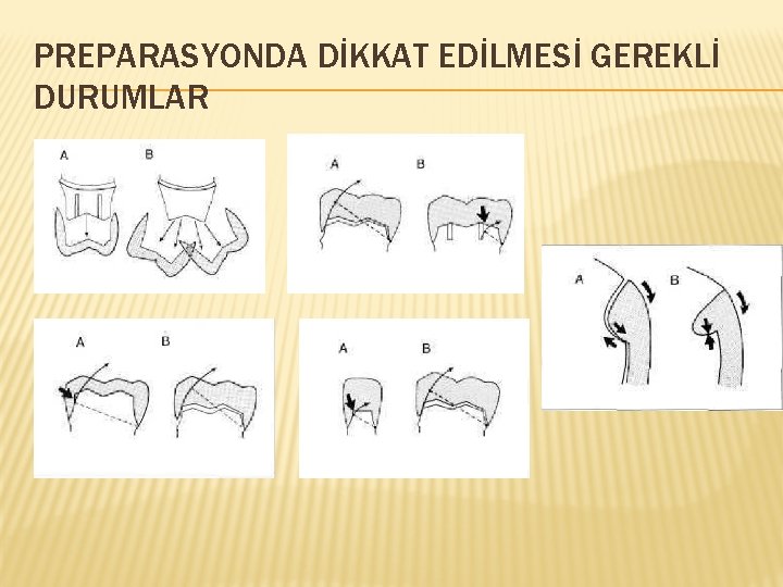 PREPARASYONDA DİKKAT EDİLMESİ GEREKLİ DURUMLAR 