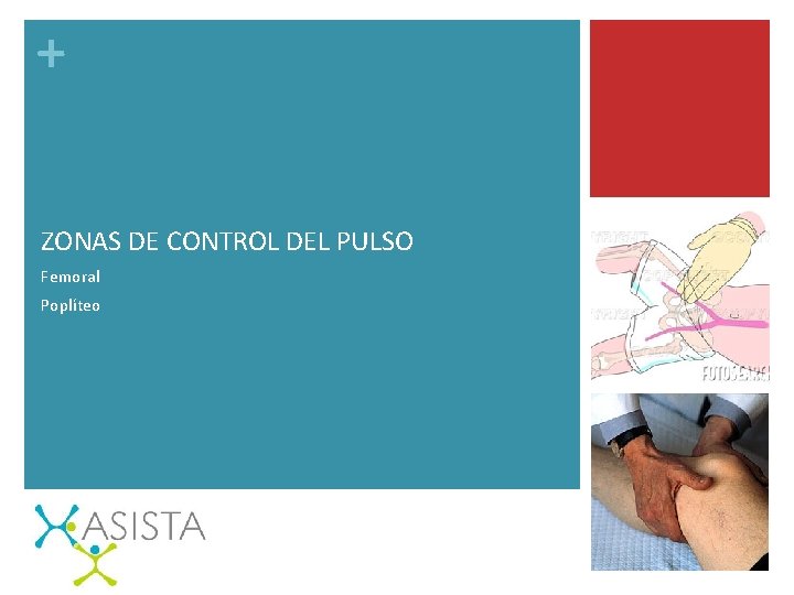 + ZONAS DE CONTROL DEL PULSO Femoral Poplíteo 