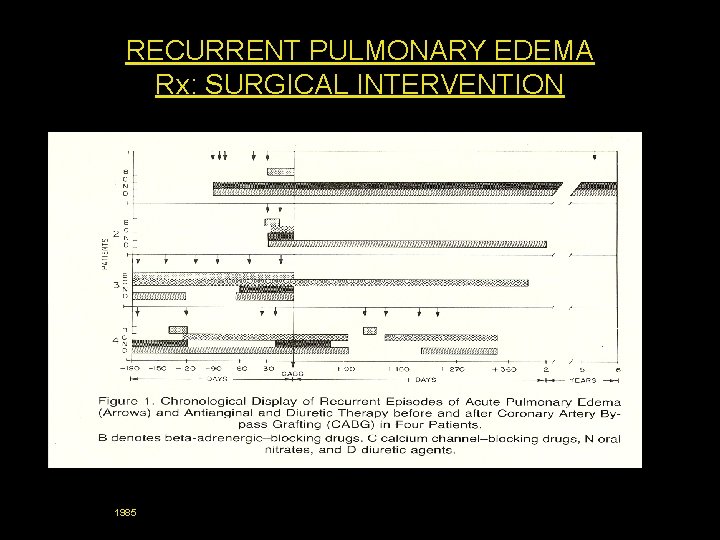 RECURRENT PULMONARY EDEMA Rx: SURGICAL INTERVENTION 1985 
