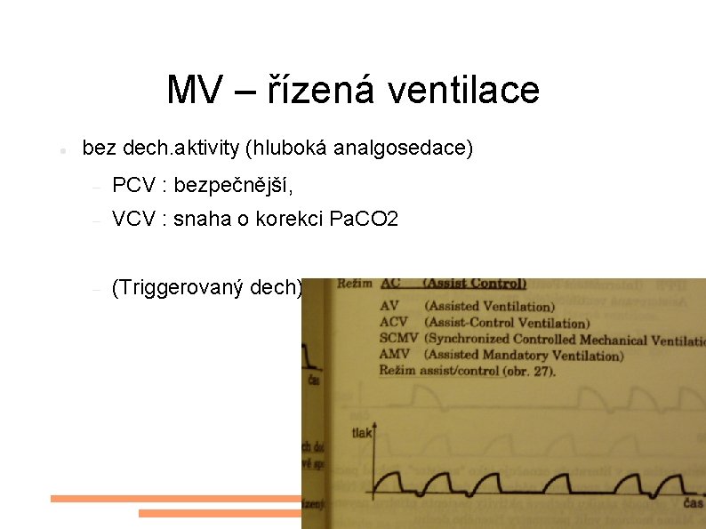 MV – řízená ventilace bez dech. aktivity (hluboká analgosedace) PCV : bezpečnější, VCV :