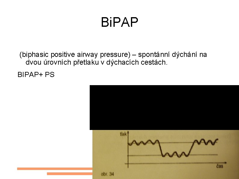 Bi. PAP (biphasic positive airway pressure) – spontánní dýchání na dvou úrovních přetlaku v
