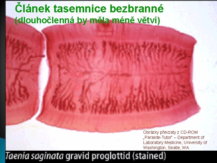 Článek tasemnice bezbranné (dlouhočlenná by měla méně větví) Obrázky převzaty z CD-ROM „Parasite-Tutor“ –