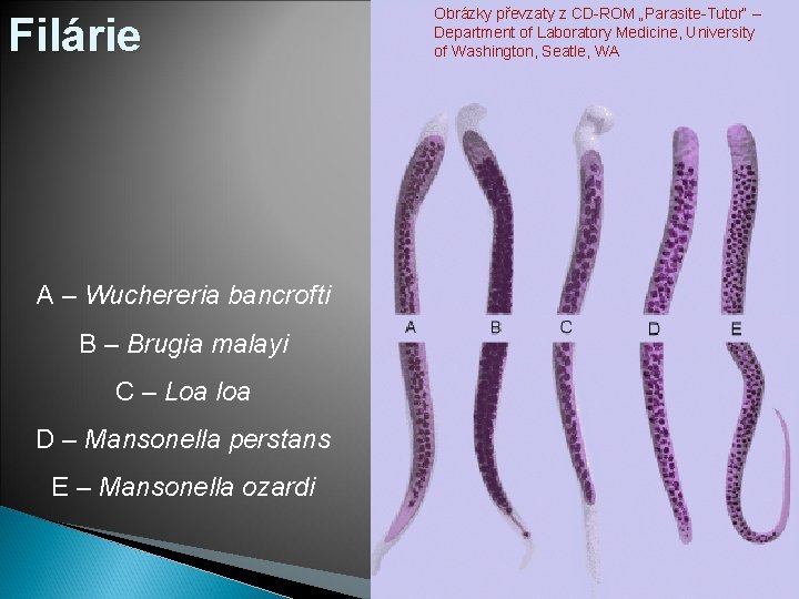 Filárie A – Wuchereria bancrofti B – Brugia malayi C – Loa loa D