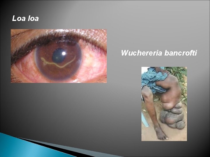 Loa loa Wuchereria bancrofti 