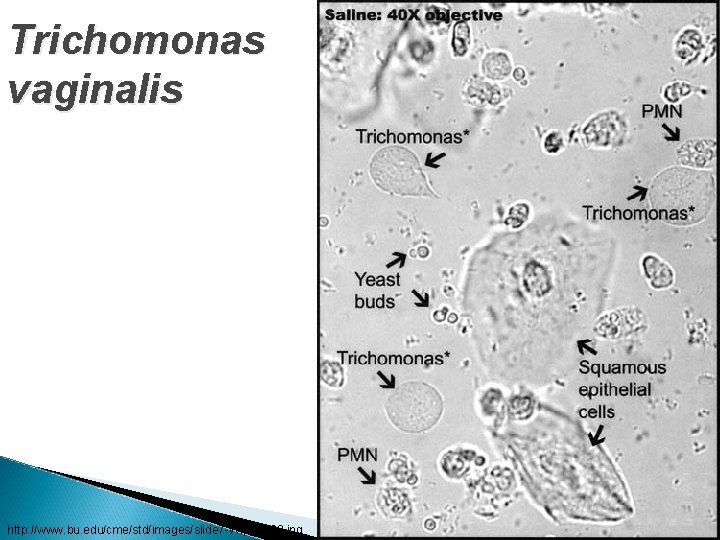 Trichomonas vaginalis http: //www. bu. edu/cme/std/images/slide 7 -vwp_g 420. jpg 