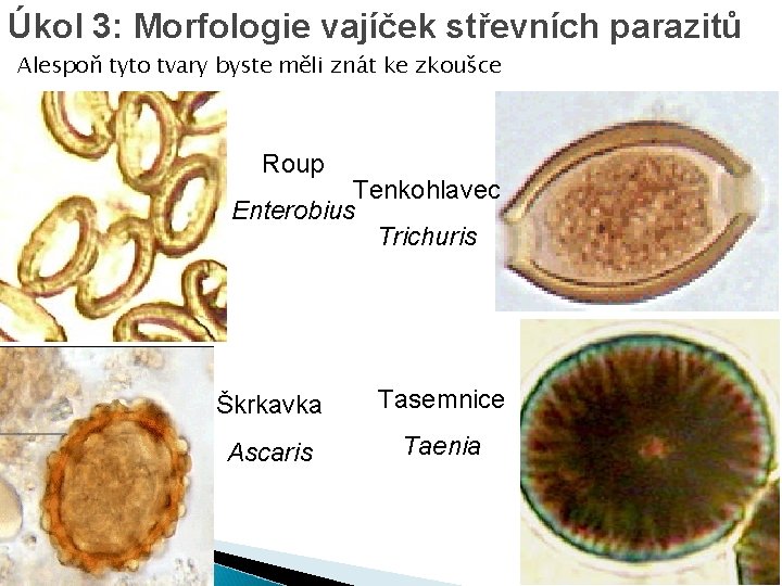 Úkol 3: Morfologie vajíček střevních parazitů Alespoň tyto tvary byste měli znát ke zkoušce