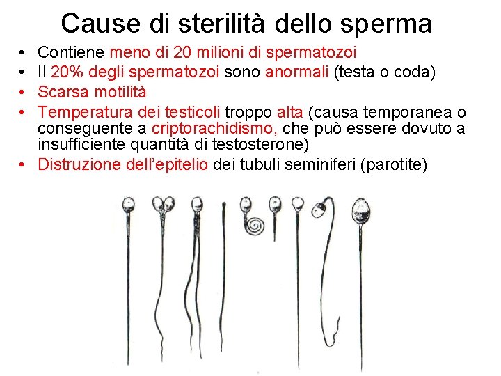Cause di sterilità dello sperma • • Contiene meno di 20 milioni di spermatozoi