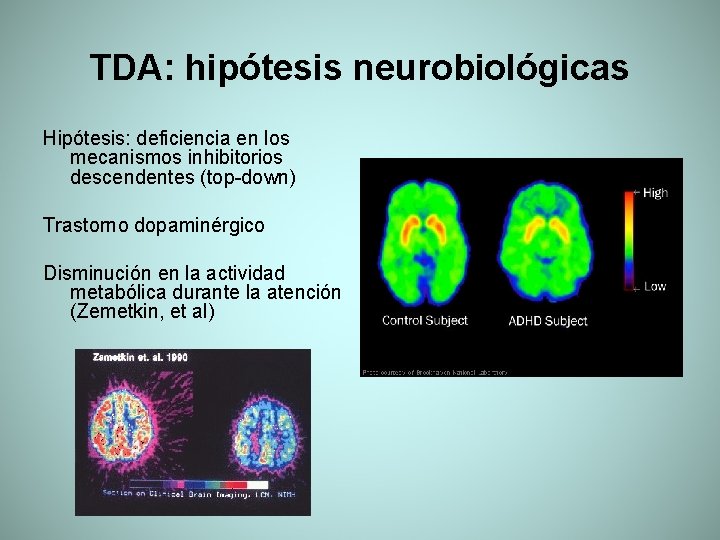 TDA: hipótesis neurobiológicas Hipótesis: deficiencia en los mecanismos inhibitorios descendentes (top-down) Trastorno dopaminérgico Disminución