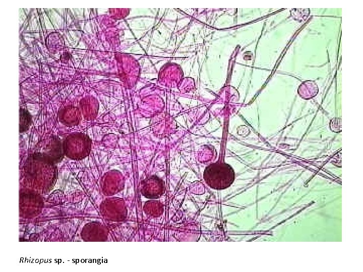 Rhizopus sp. - sporangia 