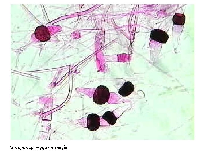 Rhizopus sp. -zygosporangia 