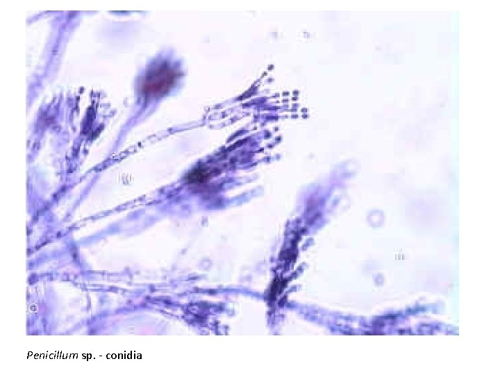 Penicillum sp. - conidia 