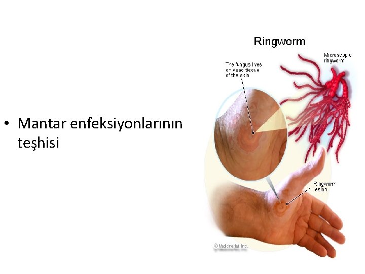  • Mantar enfeksiyonlarının teşhisi 