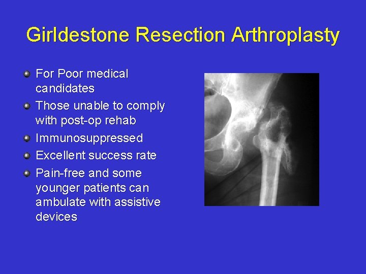 Girldestone Resection Arthroplasty For Poor medical candidates Those unable to comply with post-op rehab