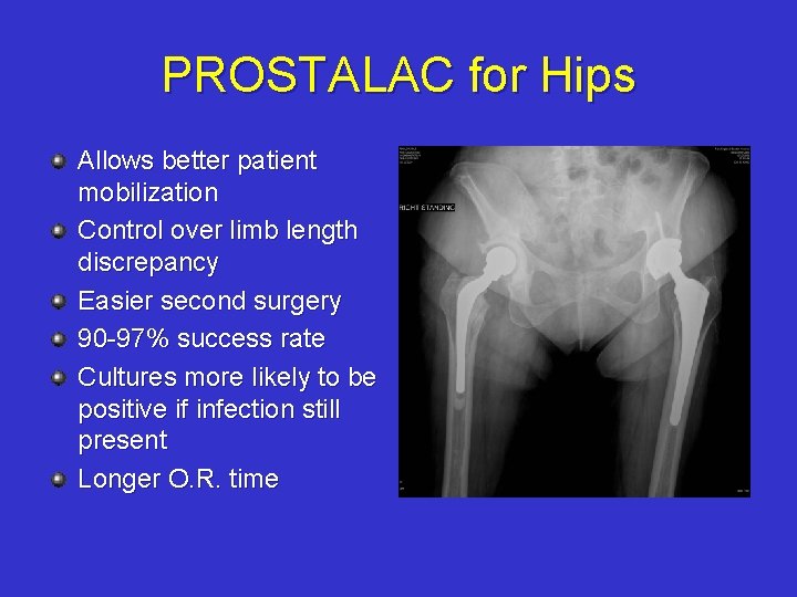 PROSTALAC for Hips Allows better patient mobilization Control over limb length discrepancy Easier second