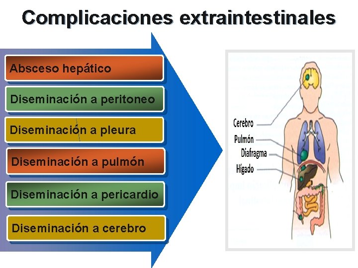 Complicaciones extraintestinales Absceso hepático Diseminación a peritoneo Diseminación a pleura Diseminación a pulmón Diseminación