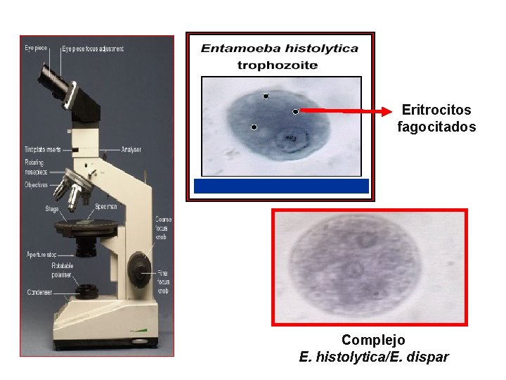 Eritrocitos fagocitados Complejo E. histolytica/E. dispar 