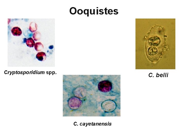 Ooquistes Cryptosporidium spp. C. belli C. cayetanensis 