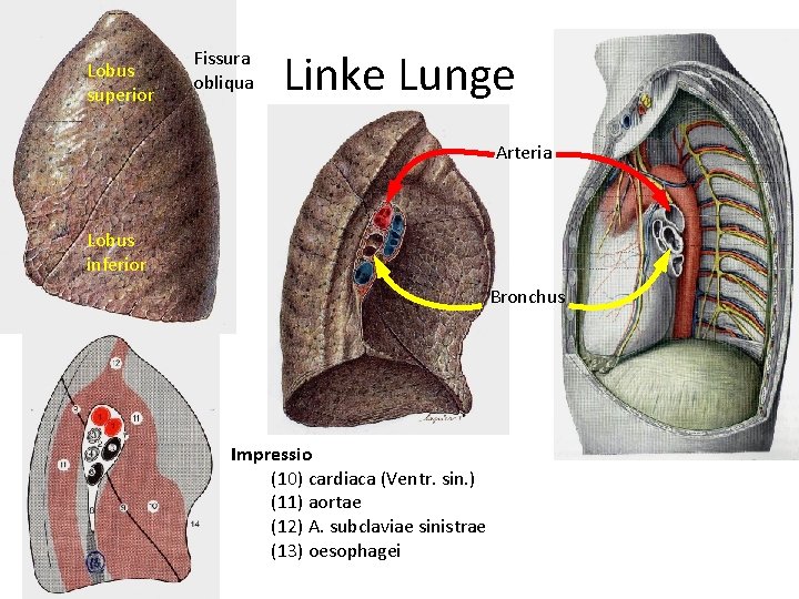 Lobus superior Fissura obliqua Linke Lunge Arteria Lobus inferior Bronchus Impressio (10) cardiaca (Ventr.