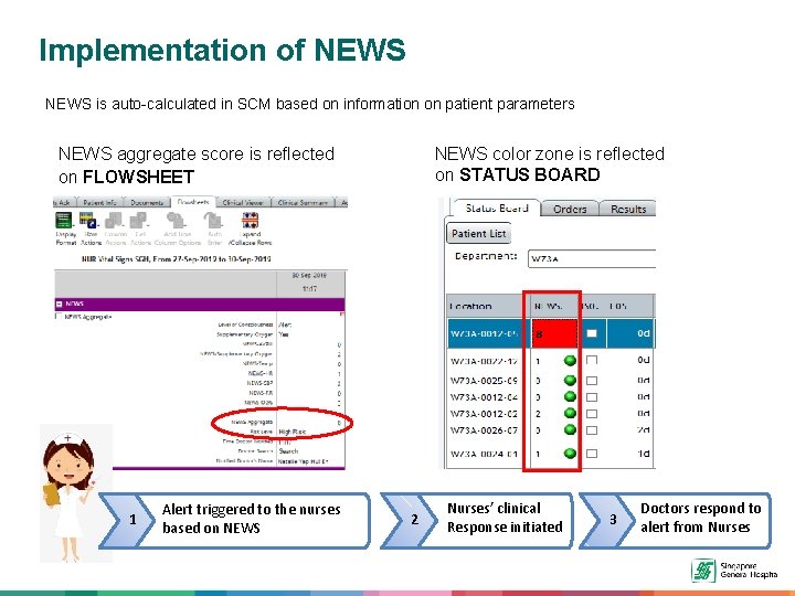 Implementation of NEWS is auto-calculated in SCM based on information on patient parameters NEWS