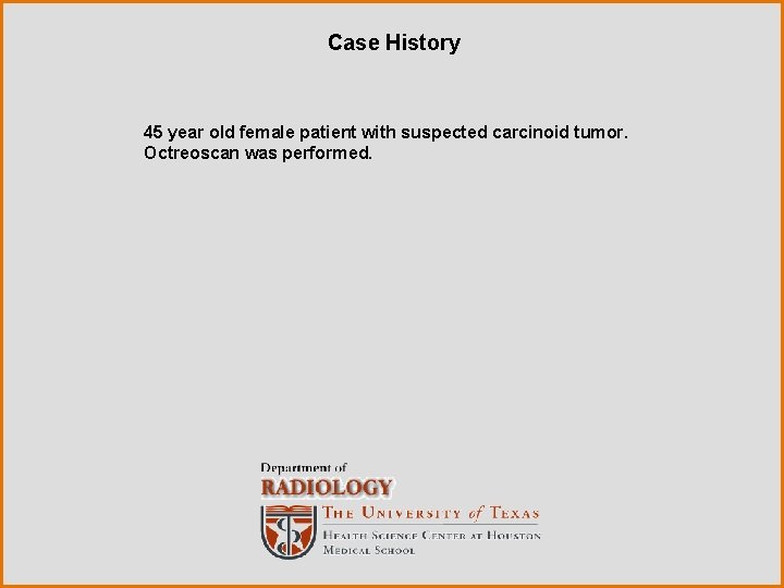 Case History 45 year old female patient with suspected carcinoid tumor. Octreoscan was performed.