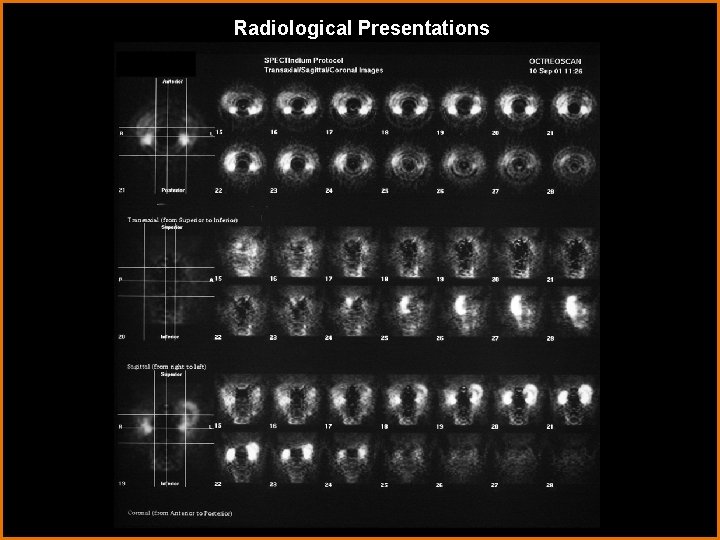 Radiological Presentations 