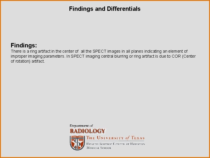 Findings and Differentials Findings: There is a ring artifact in the center of all