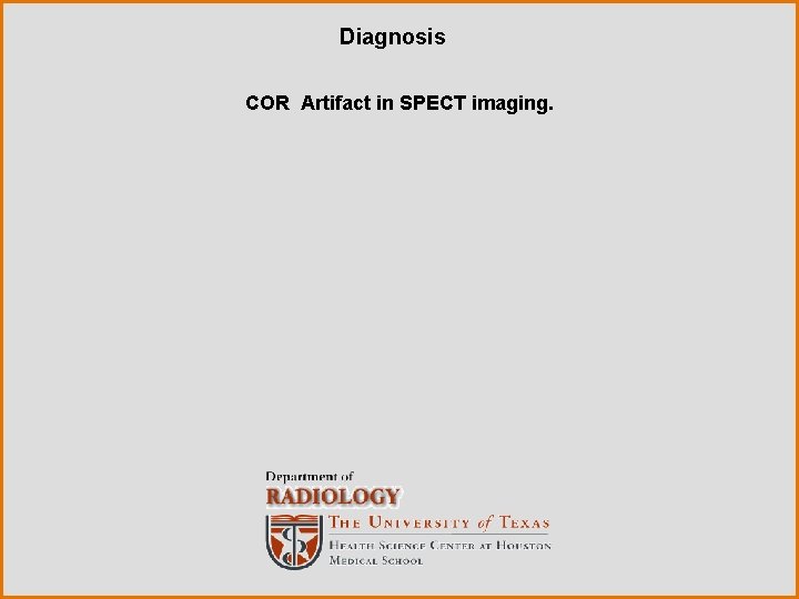 Diagnosis COR Artifact in SPECT imaging. 