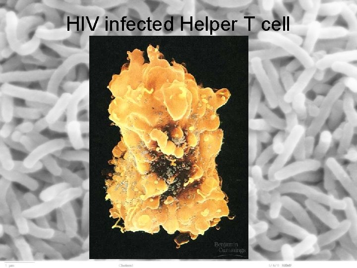 HIV infected Helper T cell 