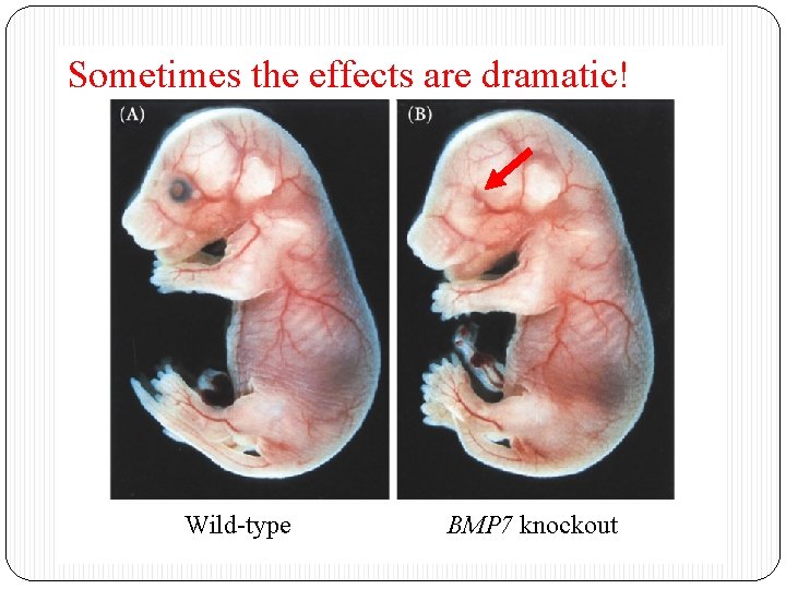 Sometimes the effects are dramatic! Wild-type BMP 7 knockout 