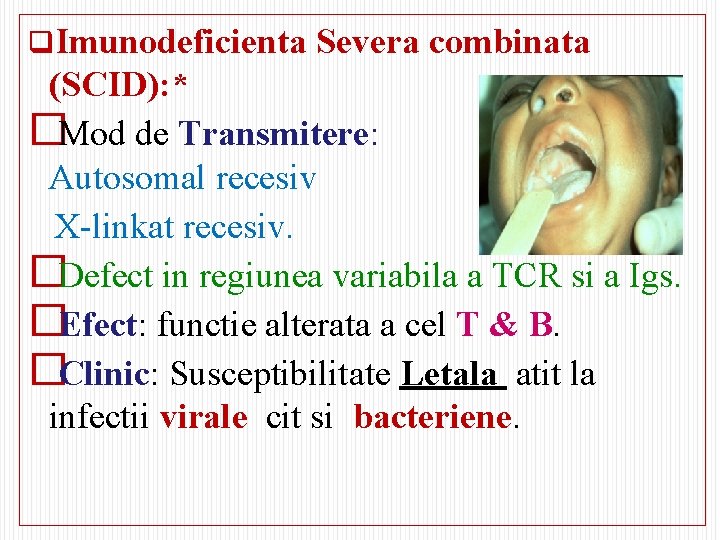 q. Imunodeficienta Severa combinata (SCID): * �Mod de Transmitere: Autosomal recesiv X-linkat recesiv. �Defect