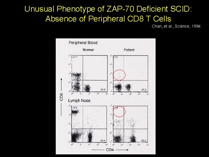 Unusual Phenotype of ZAP 70 Deficient SCID: Absence of Peripheral CD 8 T Cells