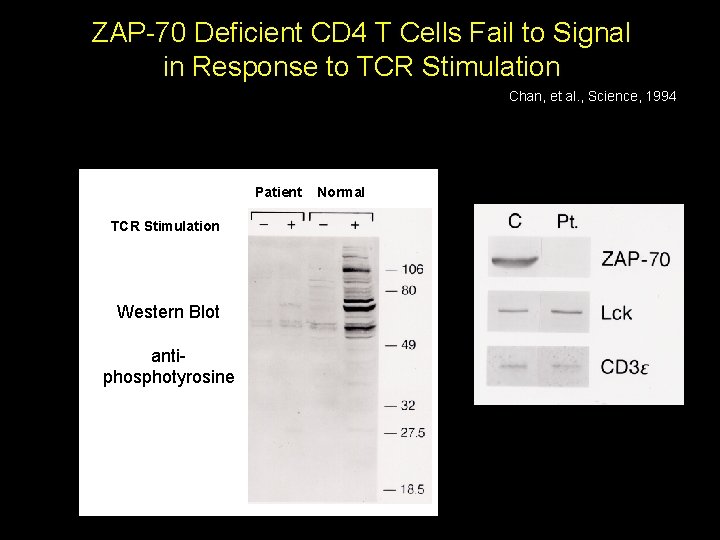 ZAP 70 Deficient CD 4 T Cells Fail to Signal in Response to TCR