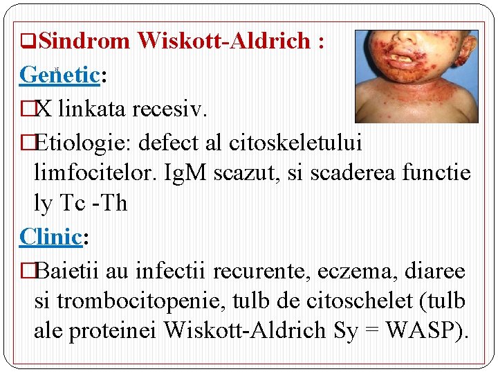 q. Sindrom Wiskott-Aldrich : Genetic: �X linkata recesiv. �Etiologie: defect al citoskeletului limfocitelor. Ig.