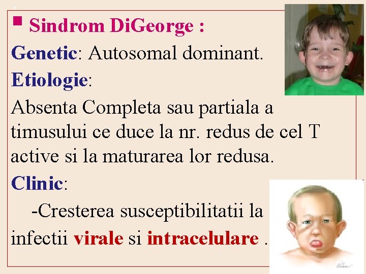 § Sindrom Di. George : N Genetic: Autosomal dominant. Etiologie: Absenta Completa sau partiala