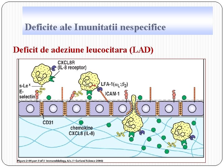 Deficite ale Imunitatii nespecifice Deficit de adeziune leucocitara (LAD) 