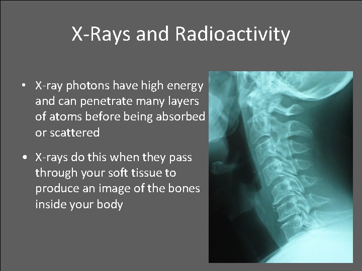 X-Rays and Radioactivity • X-ray photons have high energy and can penetrate many layers