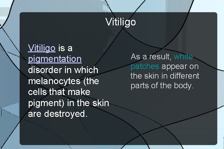 Vitiligo is a pigmentation disorder in which melanocytes (the cells that make pigment) in