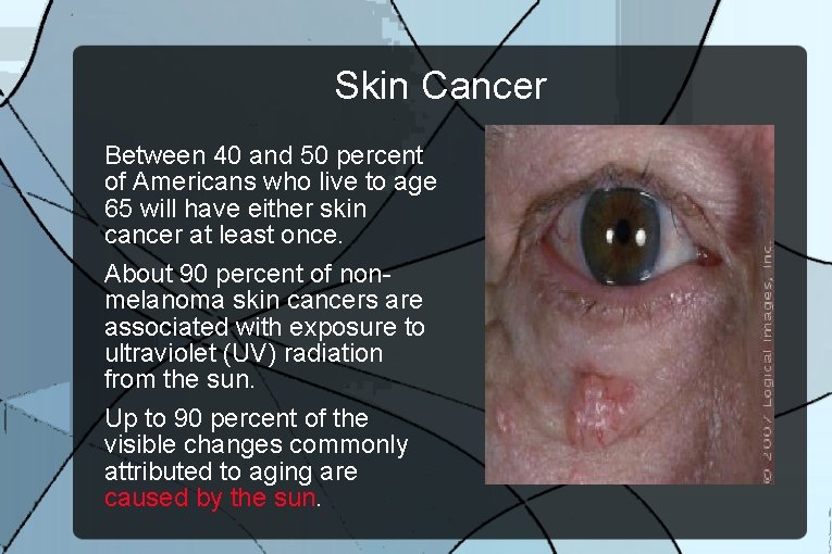 Skin Cancer Between 40 and 50 percent of Americans who live to age 65