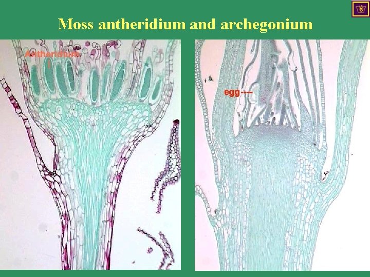 Moss antheridium and archegonium 