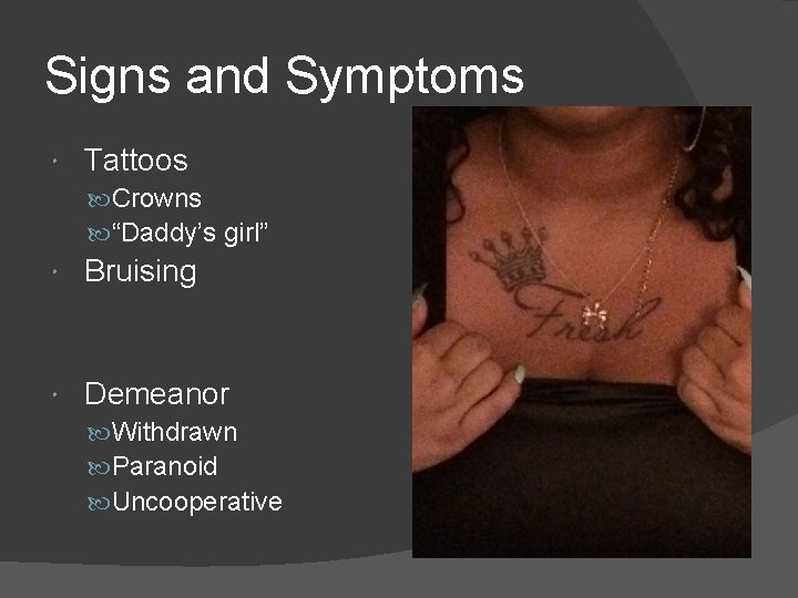 Signs and Symptoms Tattoos Crowns “Daddy’s girl” Bruising Demeanor Withdrawn Paranoid Uncooperative 