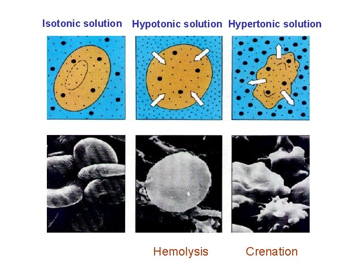 Isotonic solution Hypertonic solution Hemolysis Crenation 