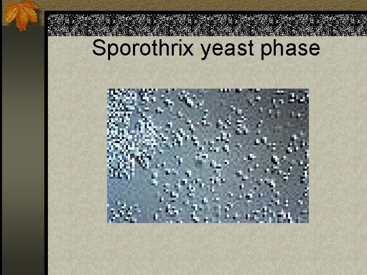 Sporothrix yeast phase 