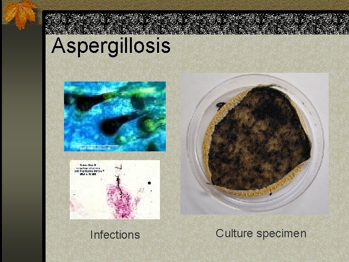 Aspergillosis Infections Culture specimen 